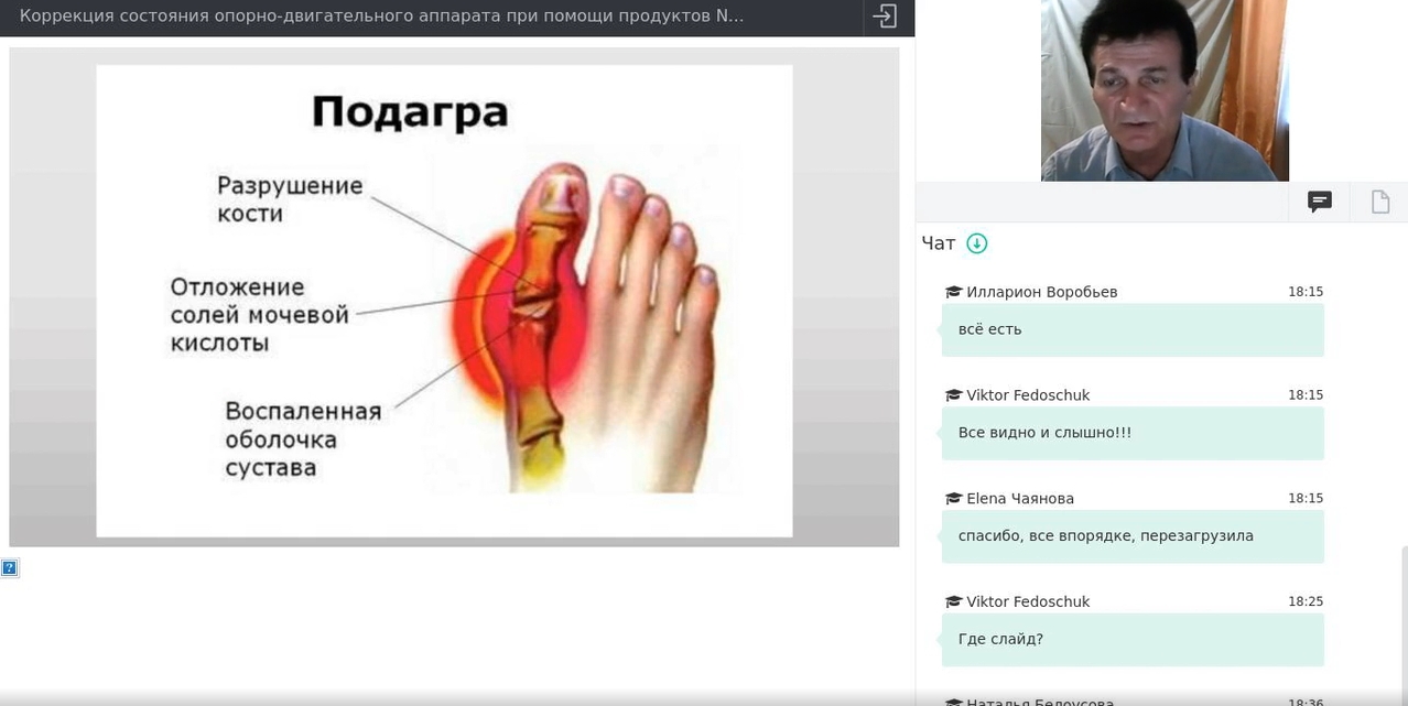 Коррекция состояний. НСП подагра. Подагра NSP. Подагра лечение НСП. Иноперабельное состояния.